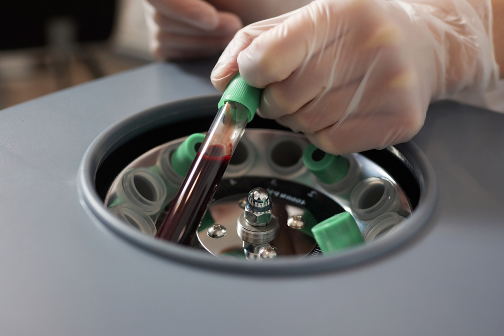 prpostate cancer<br />
